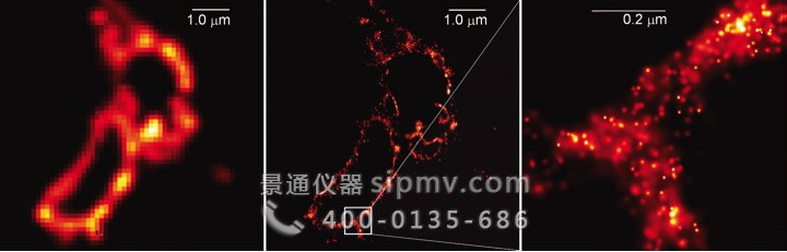 超级高分辨率溶酶体的显微镜照片