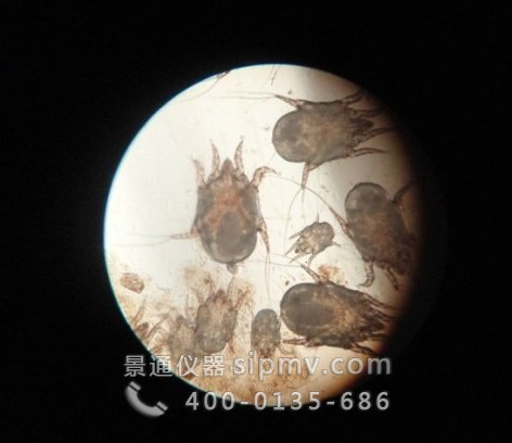 显微镜下的螨虫