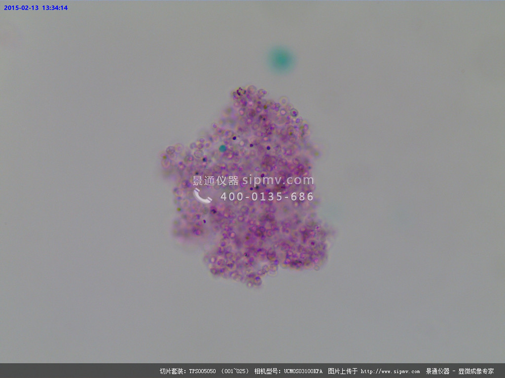 显微镜下的酵母菌