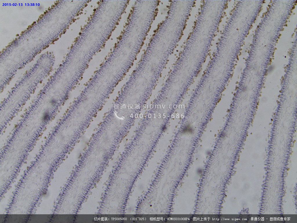 显微镜下的伞菌