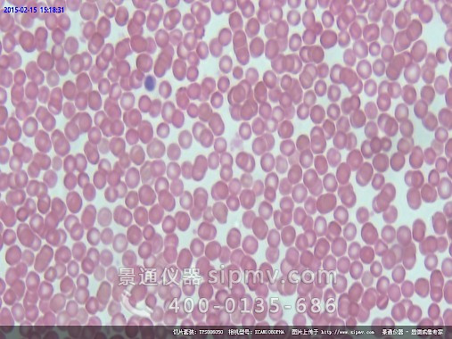 显微镜下的人血涂片