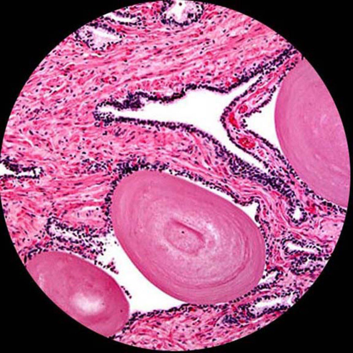 大肠杆菌(e.c oli.)细菌在显微镜下图片-商业图片-正版原创图片下载购买-VEER图片库
