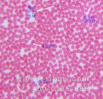 显微镜下的血细胞