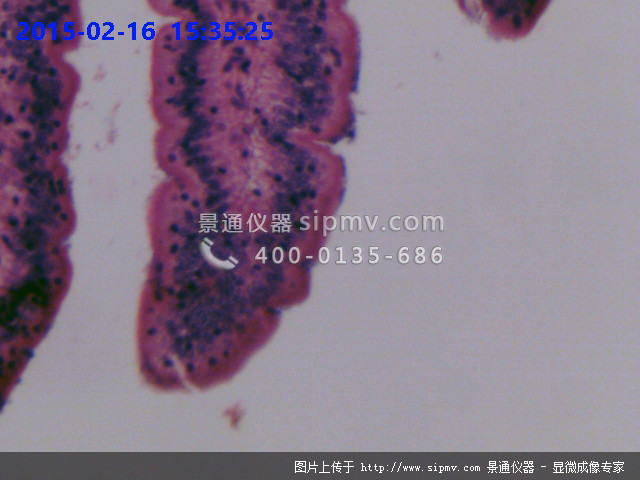 单层柱状上皮切片