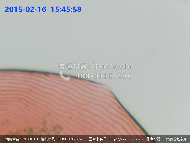小鲨鱼盾形鳞装片显微图片