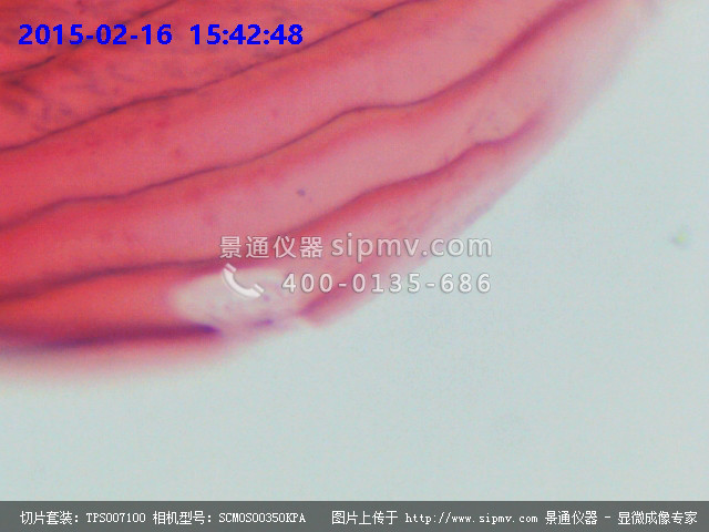 圆盘状鳞装片显微图片