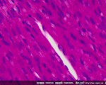 WCAM系列WCAM1080PA实拍人心肌切片显微图片