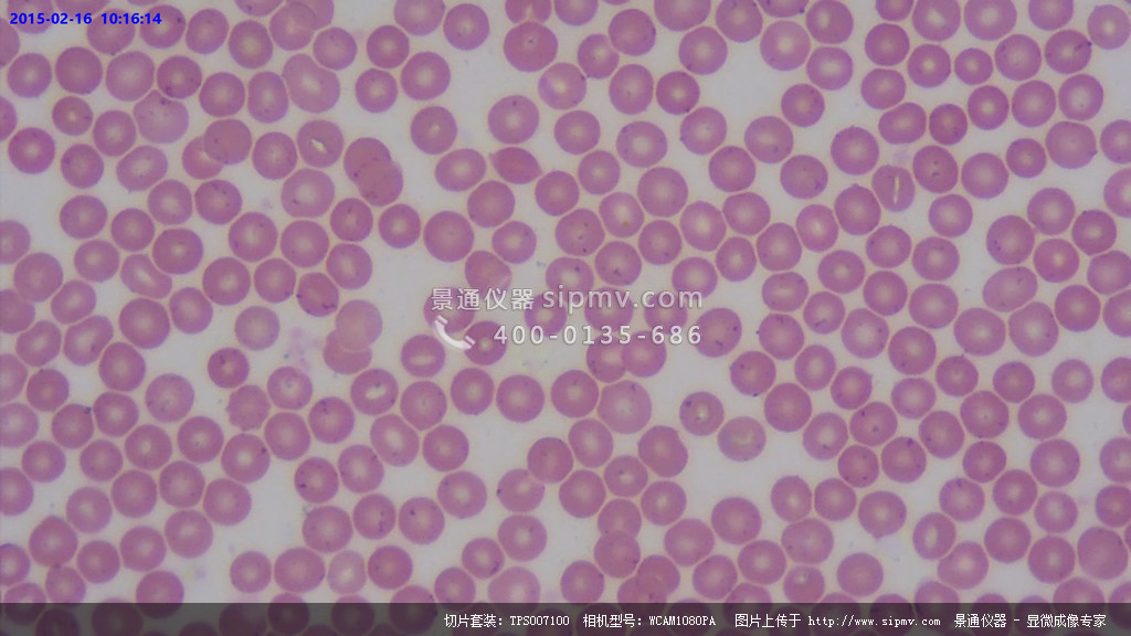 显微镜下的人血涂片