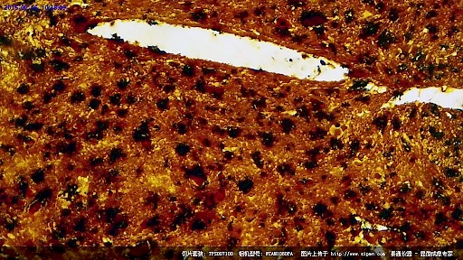 显微镜下的吐脊髓横切银染