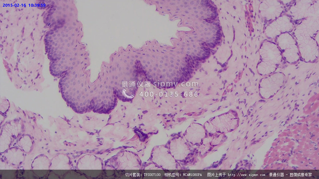 显微镜下的食道横切