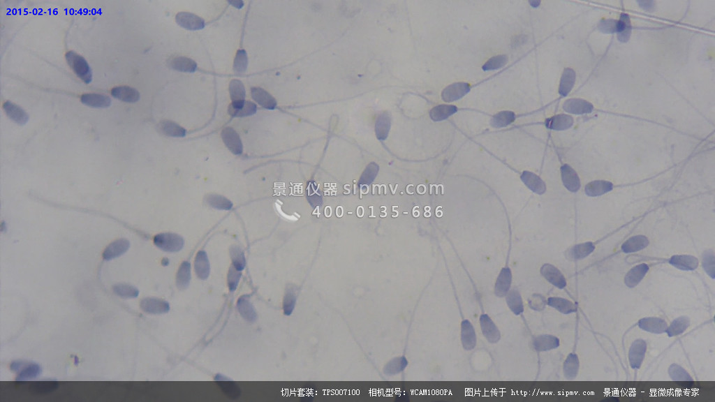 显微镜下的兔精子涂片