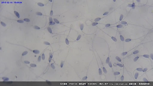显微镜下的兔精子涂片