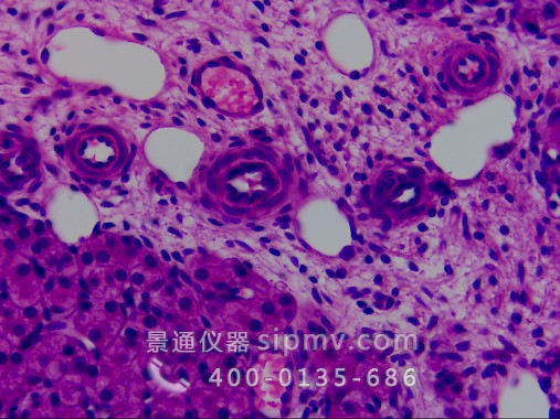 显微镜下的卵巢切片