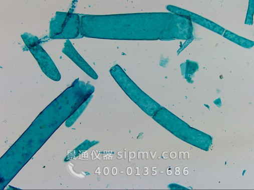 显微镜下的藓原丝体装片
