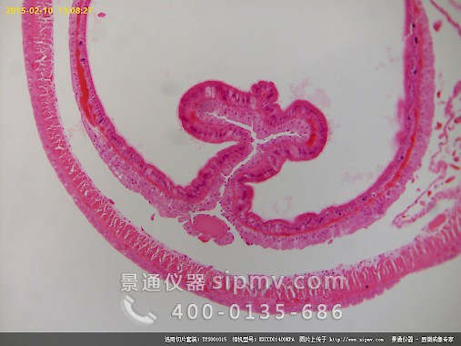 显微镜下的蚯蚓横切