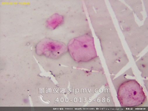 显微镜下的人口腔上皮