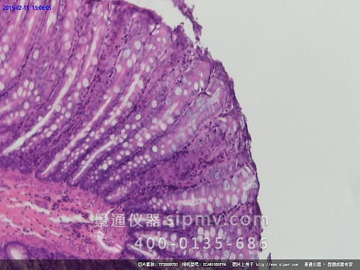 显微镜下的大肠切片