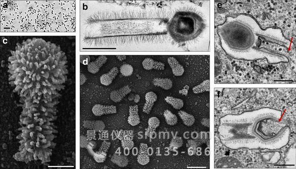 巴西诞生巨型病毒Tupanvirus可在光学显微镜下观察