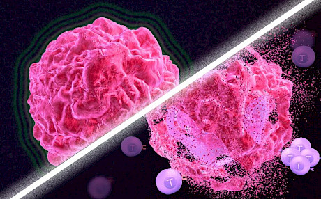 麻省理工学院的新癌症治疗启动免疫系统