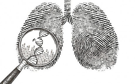 基因分析揭示了无吸烟史人群肺癌的起源