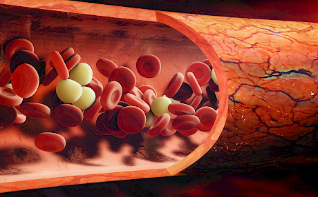 红细胞中的抗衰老蛋白有助于预防精神衰退、记忆力差和听力缺陷