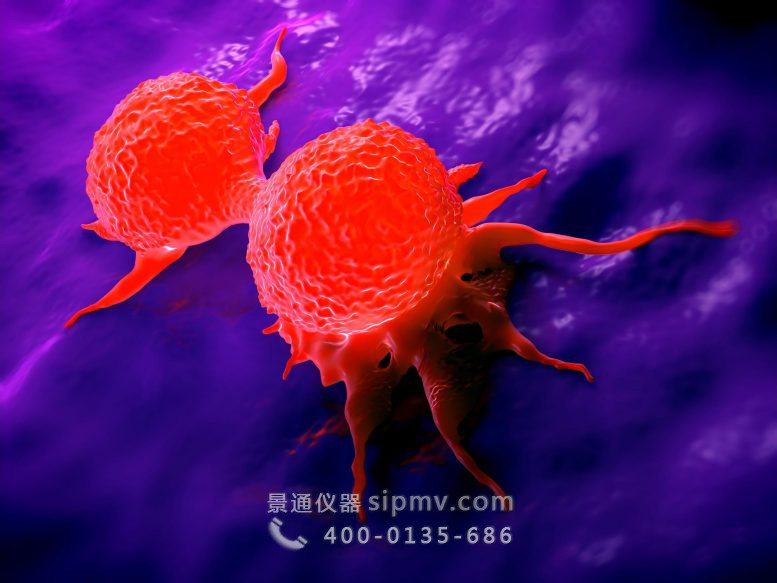 乳腺癌细胞图