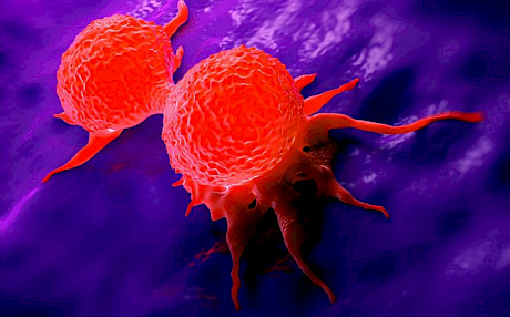 肿瘤中只有少数细胞可以使癌症扩散到身体的其他部位